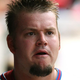 Illustration for article titled Doctors Concerned As Joe Blanton’s Goatee Flares Up Again